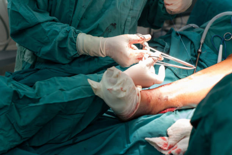 Cirurgia Ortopedica Fêmur Agendar Rio Pequeno - Cirurgia Ortopedica em Idosos