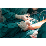 cirurgia ortopedica fêmur agendar Campo Grande