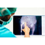 cirurgia ortopedica para o pé agendar Itatiba