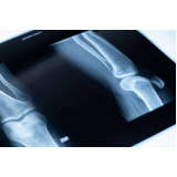 ortopedia punho agendar Itatiba